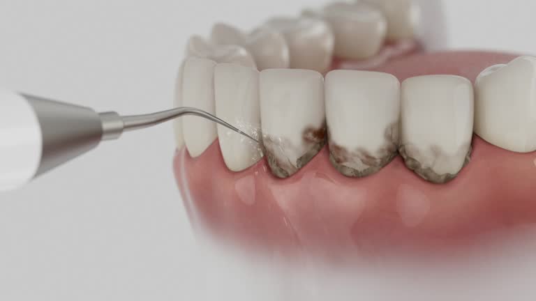Reliable Dental Implants contractor in Dorr, MI by Smile Center Dentistry
